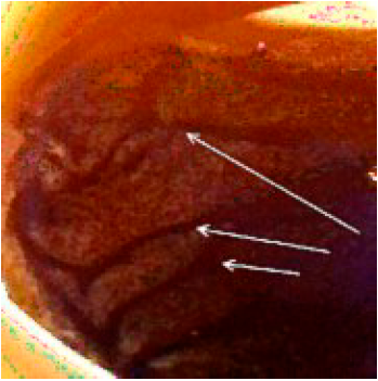 Tea Stripes image